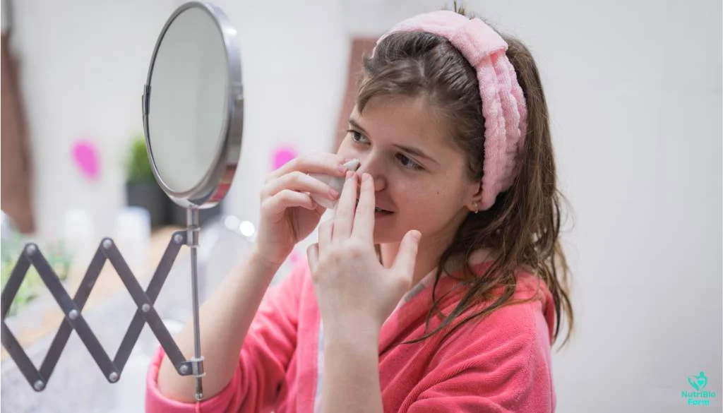 How to Prevent Blackheads from Forming