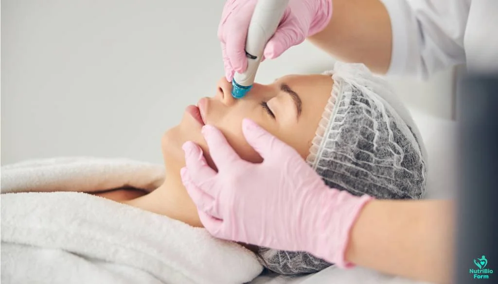 causes of blackheads