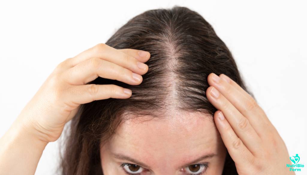 professional help for hair loss