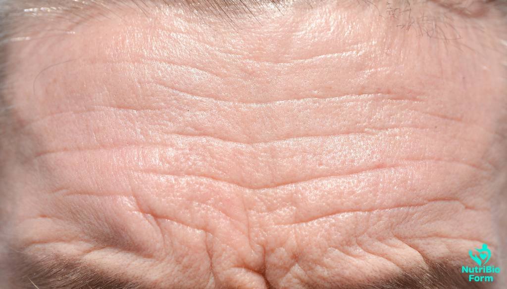 the Causes of Wrinkles